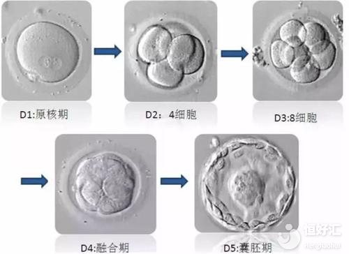  試管嬰兒胚胎等級如何劃分？花三分鐘看懂