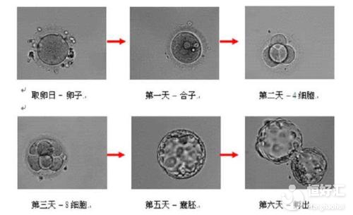 想養囊胚提高受孕率？首先要看自己合不合格