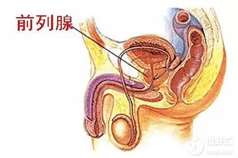 前列腺炎影響試管嗎