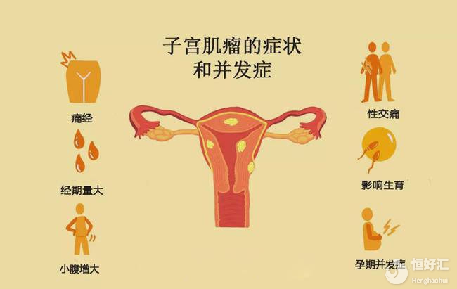 子宮肌瘤會影響懷孕并導致不孕嗎？